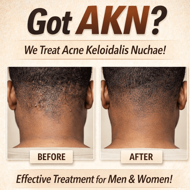 AKN Corrective Series (L1) at Hy Maintenance Skin in Atlanta, GA