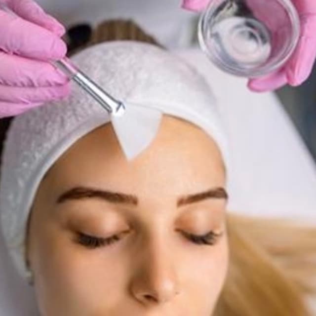 Advanced Resurfacing Peel Series at Hy Maintenance Skin in Atlanta, GA
